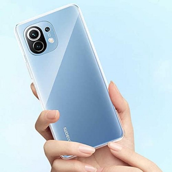 Xiaomi Mi 11 Lite Lux Seri Premium Şeffaf Silikon Kılıf