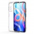 Xiaomi Redmi Note 11 Lux Seri Kamera Korumalı Premium Şeffaf Silikon Kılıf